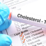 Nowatorski zastrzyk przeciwcholesterolowy – koniec ery statyn?