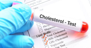Nowatorski zastrzyk przeciwcholesterolowy – koniec ery statyn?